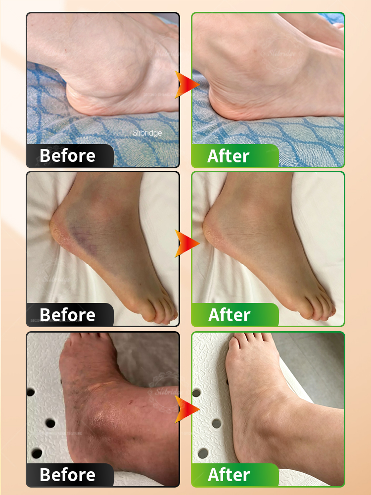 جهاز تدليك الكاحل المحمول بالح - مراجعة Ankle Brace Support وسعره